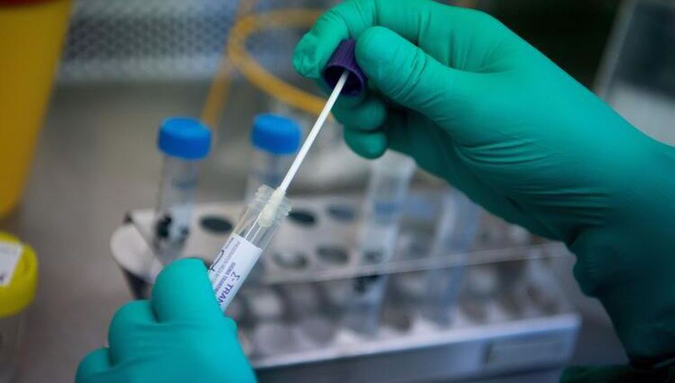 30 χιλιάδες επιχορήγηση από το κιτ δοκιμής PCR της Τουρκίας
